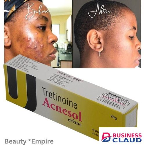 tretinoin Acnesol Acne Cream 25g - Powerful Acne Treatment for Clearer, Smoother Skin