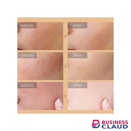 Snail Skin Repairing Cream – 3PCS