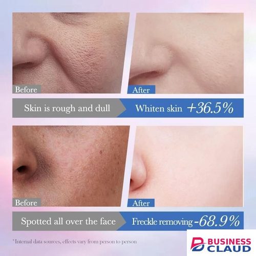 SADOER 2 in 1 Niacinamide Face Cream+Serum 10% With Alpha Arbutin Ceramide Anti Aging Cream for Moisturize Skin, Oil Control, Pores Reducer, and Delay Aging, Niacinamide Face Cream Moisturizing, Smoothening,Repairing, And Anti-aging/Anti -wrinkle