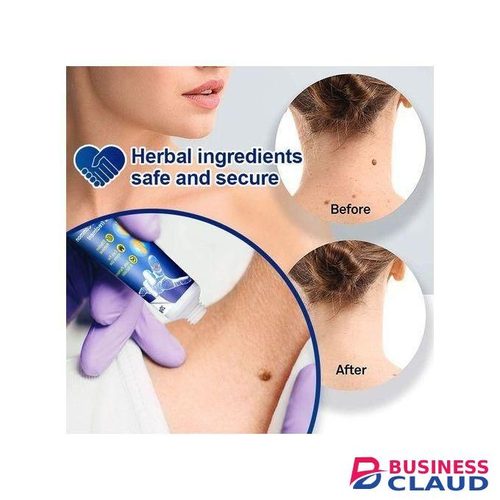 Sumifun Warts Remover Cream Warts Removal Ointment Skin Tag Remover