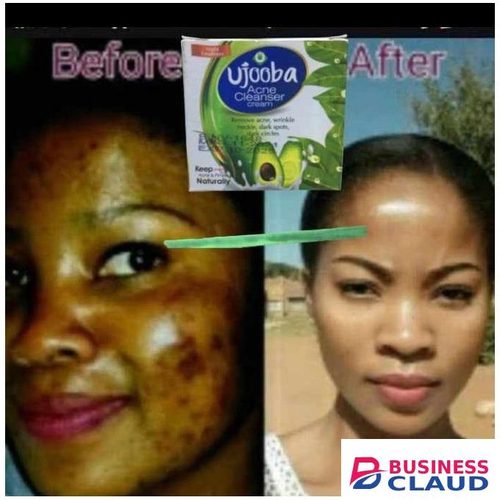 Ujooba Acne Cleaner Cream