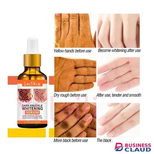 LAN SYADE Knuckles Remover Serum Dark Spot Corrector Serum Elbows Knees