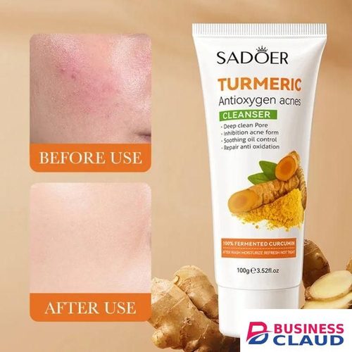 SADOER 5 In 1 Mosturising Turmeric Set, Tumeric Cleanser + Face Serum +Face Toner + Face Cream + Tumeric Soap, With Unparelled Vitamin C Capabilities, Helps In Prevent Acne, Sooth, Hydrate, Lighten Acne Marks