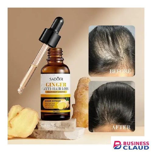 SADOER Quality 2 Pieces Anti Hair Loss Treatment Essence, Hair Growth Ginger Extract Beard Growth,Hair Growth, Anti Dandruffs Hair Moisturizing Hair Care Serum, Derma Roller compliment in Anti Hair Loss