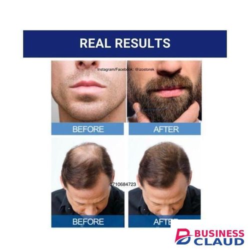 Kirkland Minoxidil Minoxidil 5% Extra Strength Hair Loss Regrowth System Treatment For Men Beard Care Oil Premium Topical Solution Growth Nourishing Serum 6 Bottle Of 60ml (6 Months Supply)