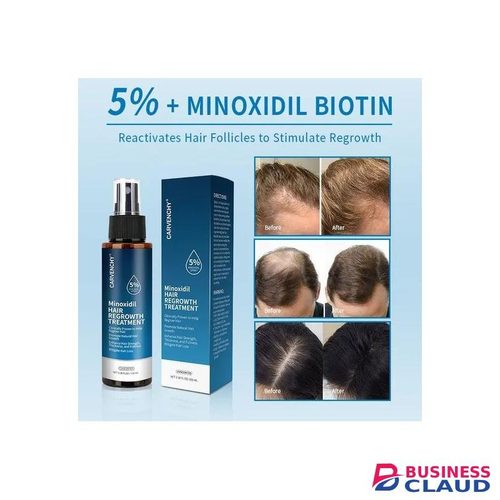 Carvenchy Minoxidil Hair Regrowth Treatment 5% Spray 100ml Advanced Hair Growth Solution That Strengthens Roots Reduces Hair Loss And Promotes Thicker Fuller Hair