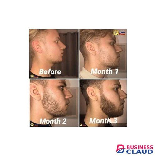 Derma Roller For Beard & Hair Growth, Anti Aging,Removes Stretchmarks Boosts Minoxidil Absorption,Clearer Skin & Collagen Boost Anti-acne, Anti-aging, Antiwrinkle & Skin Rejuvenation