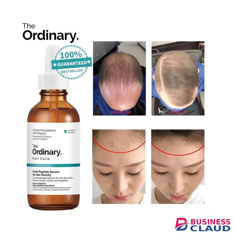 The Ordinary Natural Ingredients Hair Growth Multi-Peptide Serum-Baldness Hair Loss