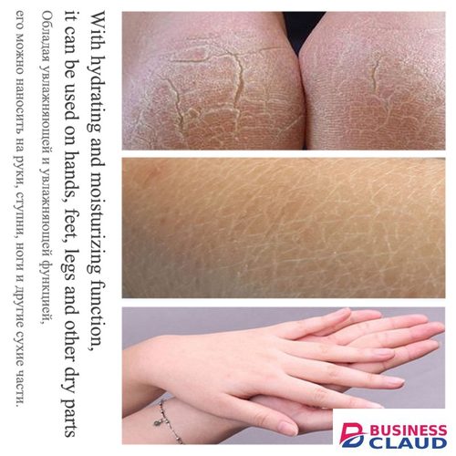 85g Anti Crack Foot Cream Dryness Foot Mask Heel Cracked Repair Cream Hand Mositurizing Removal Callus Dead Skin Hands Feet Care 4.5 in Kenya-premium-incense-scent