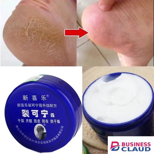 Anti-Crack Repair Cream 88g Moisturizing Anti-Dry Hand, Foot and Heel Crack King Cream Face Cream in Kenya-premium-incense-scent