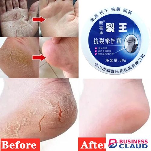 Anti-Crack Repair Cream 88g Moisturizing Anti-Dry Hand, Foot and Heel Crack King Cream Face Cream in Kenya-premium-incense-scent