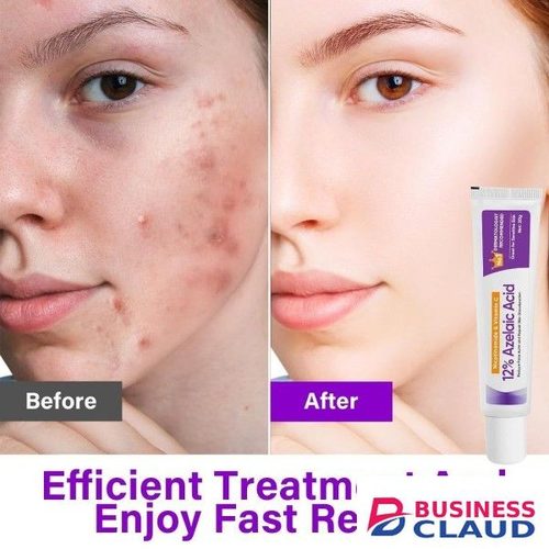 12% Facial Cream Facial Cream Moisturizing Azelaic Acid Serum in Kenya-premium-incense-scent