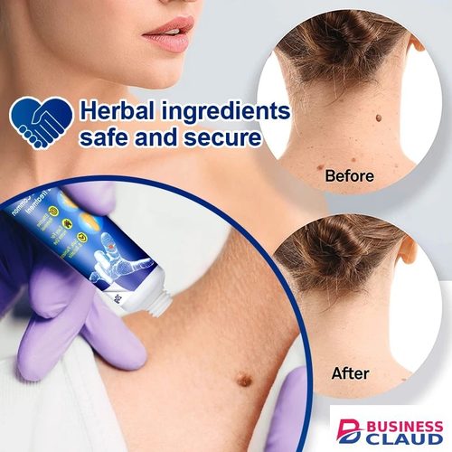 Sumifun Warts Remover Antibacterial Ointment Wart Treatment Cream Skin Tag Remover Herbal Extract Corn Plaster Warts Ointment in Kenya-premium-incense-scent