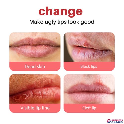 Lip Balm For Remove Dark Lip Moisturizing Lightening Melanin Whitening Plumper Extreme Gloss Pink Lips Skin Care For Men Women in Kenya-premium-incense-scent