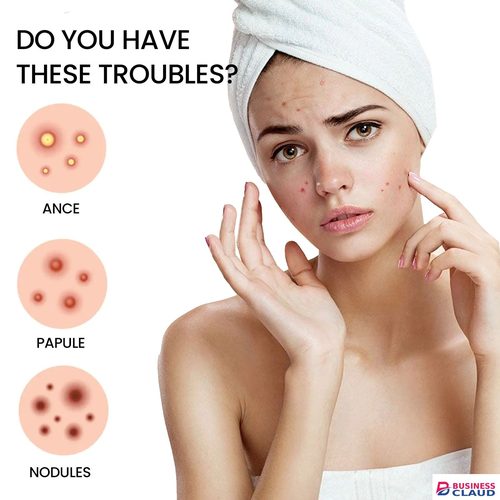 200pcs Pimple Patch Repair Acne Patch Facial Skin Care Fade Blemishes Pimple Marks Closed Acne Blemishes Cover Acne Pimple Repair Patch in 1-l-uodais-hair-repair-oil-serum-nodeg5-noir-curl-keeper-spray-smoothing-damaged-hair-treatment