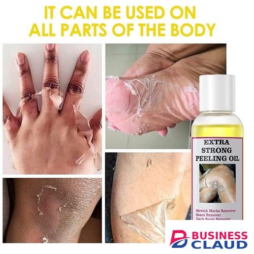 Extra Strong Peeling Oil, Peeling Oil for Dark Skin, Yellow Peeling Oil, Exfoliating Peeling Solution for Hand Feet, Chemical Peel for Face, 110ML in Kenya-premium-incense-scent