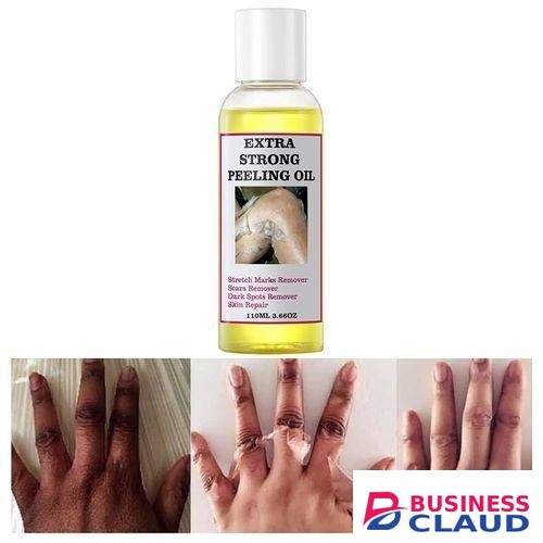 Extra Strong Peeling Oil, Peeling Oil for Dark Skin, Yellow Peeling Oil, Exfoliating Peeling Solution for Hand Feet, Chemical Peel for Face, 110ML in Kenya-premium-incense-scent