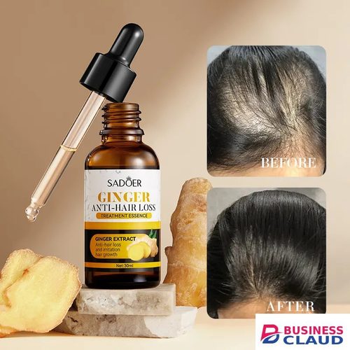 2 in 1, MicroDerma Therapy 0.5mm Derma Roller System + Free Sadoer Anti Hairloss, Sadoer Hair Growth Serum in 1-microderma-therapy-0-5mm-derma-roller-system-free-sadoer-anti-hairloss-sadoer-hair-growth-ser