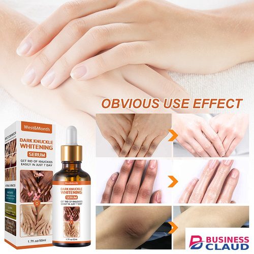 Dark Knuckle Whitening Serum Skin Brightening Oil Dark Spots Removal Body Bleaching Serum Skin Care Kit in 1-l-uodais-hair-repair-oil-serum-nodeg5-noir-curl-keeper-spray-smoothing-damaged-hair-treatment