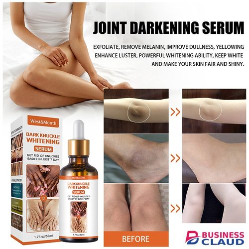 Dark Knuckle Whitening Serum Skin Brightening Oil Dark Spots Removal Body Bleaching Serum Skin Care Kit in 1-l-uodais-hair-repair-oil-serum-nodeg5-noir-curl-keeper-spray-smoothing-damaged-hair-treatment