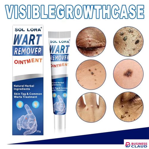 Warts Remover Antibacterial Ointment Wart Treatment Cream Skin Tag Remover Wart removal cream, wart flattening corns cream, flat warts, warts, corns and moles cream in Kenya-premium-incense-scent