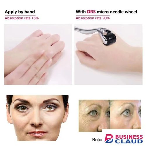 Micro Needle 540 Roller Derma Roller Dermaroller Titanium Hair Regrowth Beard Growth Anti Hair Loss Treatment Thinning Receding in 1-formula-1500mg-knee-elbow-bone-hea