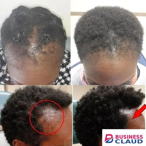 Natural 100% Pure Batana Oil Butter Hair Mask Anti Break Loss Hair Growth From Honduras Hair Loss Treatment For Black Men Women