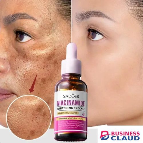 Niacinamide Dark Spot Remover Serum for Face Whitening Moisturizing Brighten Smoothing Facial Skin Care Removal Freckle Facial Serum Skin Care - SADOER - in Kenya-premium-incense-scent