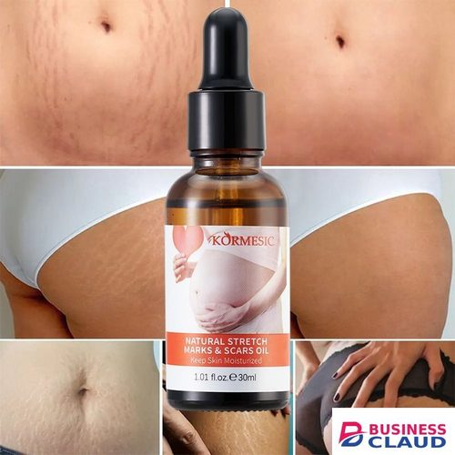 Removes Stretch Mark Oil Body,Legs Belly,Legs Stretch Marks Removal Women Repair Anti-Aging Anti-Winkles Cream Increase Elasticity Smooth Firm Skin Care - KORMESIC -