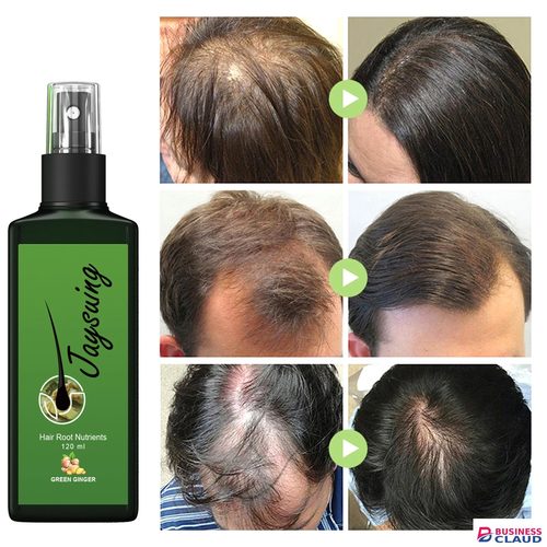 120ml Jaysuing Hair Growth Oil Strong hair Scalp Massage Liquid Fast Growing Germinal Anti-loss Treatment Serum Hair Lotion