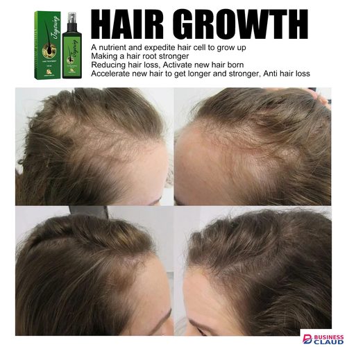 120ml Jaysuing Hair Growth Oil Strong hair Scalp Massage Liquid Fast Growing Germinal Anti-loss Treatment Serum Hair Lotion in Kenya-premium-incense-scent