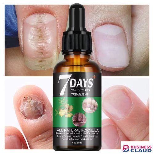 Effective Nail Fungus Treatment Oil Foot Toe Nail Fungus Removal Serum Anti-infection Paronychia Onychomycosis Repair Gel Care- -