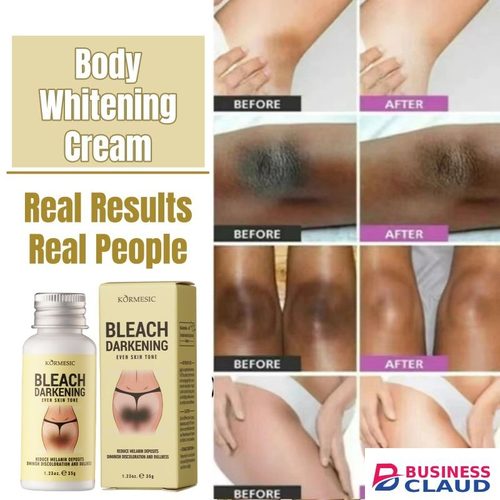 KORMESIC Niacinamide Body Whitening Cream Darkening Bleach Private Parts Underarm Inner Thigh Intimate Bleaching Serum Whiten Knee Butt Knuckles Brighten Cream Armpits Elbow Knees Joint Dark Spots in Kenya-premium-incense-scent