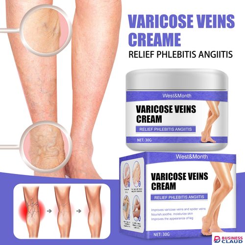 Effective Varicose Veins Relief Cream Relieve Vasculitis Phlebitis Spider Pain Treatment Ointment Medical Plaster Body Care 30g
