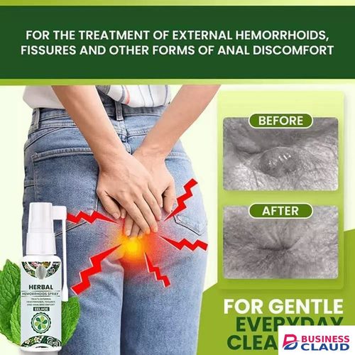 New health care Natural Herbal Hemorrhoid Spray 30MLTreatment Internal Hemorrhoids Piles External Anal Fissure