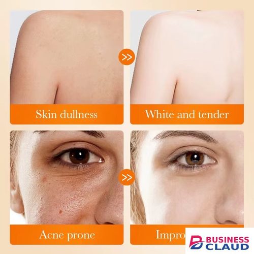 SADOER Kojic Acid Whitening Soap Body Cleaning Lightening Dark Underarm Leg Handmade Bath Soap Body Cleansers Brightening Face Soap Tender Skin Care in Kenya-premium-incense-scent