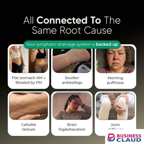 New Maximum Potency Formula - Lymphatic Drainage Capsules by Sculptique