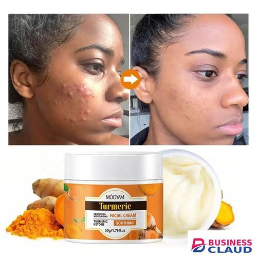 New Tumeric Face Cream for Dark Spots – Natural Turmeric Skin Brightening Lotion for Face & Body – Cleanse Skin, Fight Acne, Even Tone, Clear Scars, Sun Damage, & Hyperpigmentation – 50g -