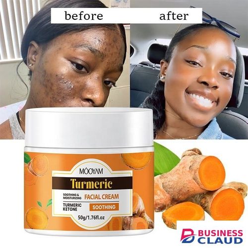 New New Tumeric Face Cream for Dark Spots – Natural Turmeric Skin Brightening Lotion for Face & Body – Cleanse Skin, Fight Acne, Even Tone, Clear Scars, Sun Damage, & Hyperpigmentation – 50g - in Kenya-premium-incense-scent