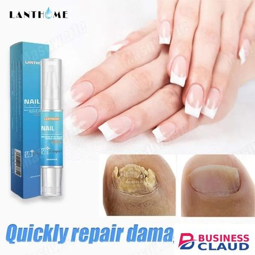 Fungal Nail Treatment Serum Foot Nail Fungus Removal Repair Gel Anti Infection Paronychia Onychomycosis Foot Nails Care Essence - LANTHOME- in 1-electric-hair-straightener-brush-dryer-ceramic-heating-blow-dryer-curling-iro