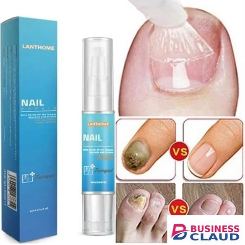7 Days Nail Fungal Treatment Essence Oil Foot Toe Nail Fungus Removal Serum Repair Onychomycosi Anti Infection Gel Care Products - LANTHOME - in 1-electric-hair-straightener-brush-dryer-ceramic-heating-blow-dryer-curling-iro