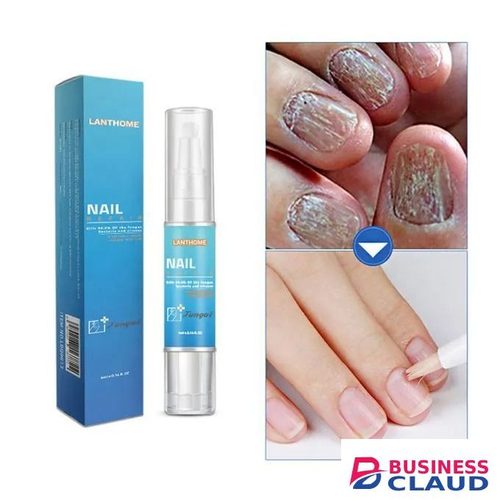 7 Days Nail Fungal Treatment Essence Oil Foot Toe Nail Fungus Removal Serum Repair Onychomycosi Anti Infection Gel Care Products - LANTHOME -