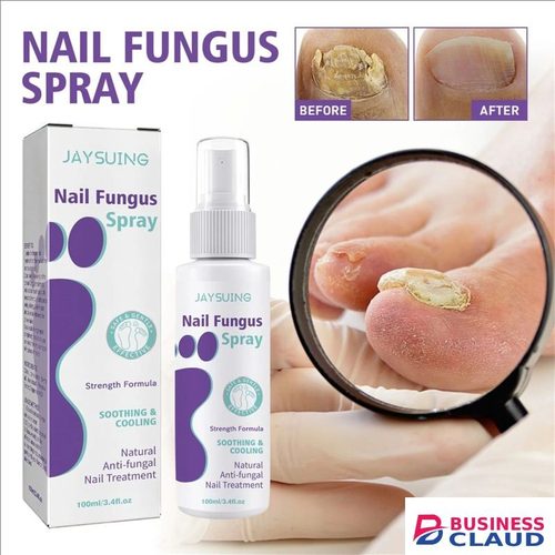 New New 100ml Toenail Fungus Care Fastacting Nail Care Liquid For Fungus Under & Around Restores The Healthy Appearance Of Nails in 1-hot-comb-straightener-electric-hair-straightener-hair-curler-wet-dry-use-hair-flat-irons-hot