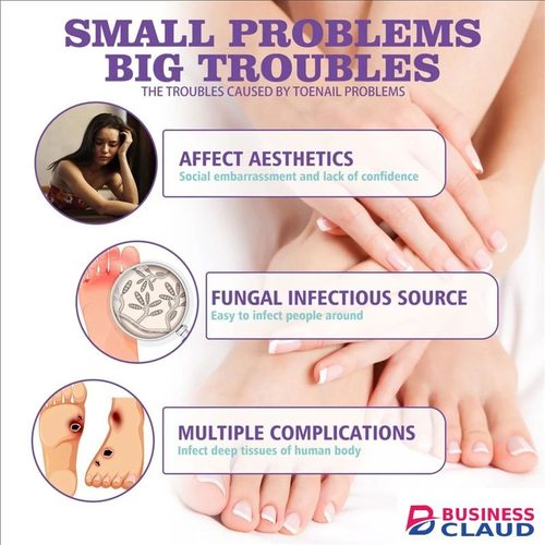 New 100ml Toenail Fungus Care Fastacting Nail Care Liquid For Fungus Under & Around Restores The Healthy Appearance Of Nails