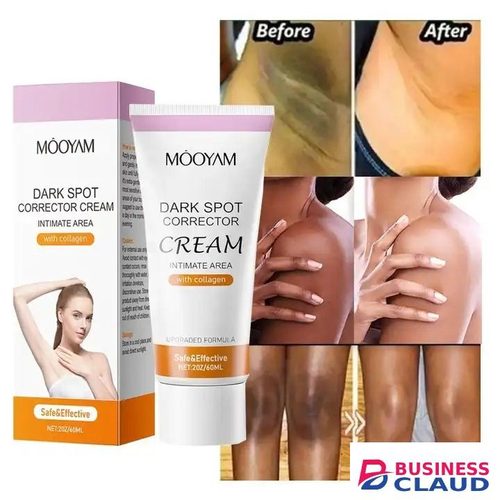 Whitening Cream dark Spots Remover Knuckles Skin Lightening Bleaching Cream Underarm Armpit Knees Elbows Dark Skin Whitening Intimate Body- MOOYAM - in Kenya-premium-incense-scent