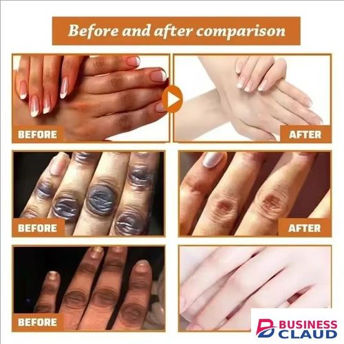 Hand Cream Fast Whitening Dark Knuckles Brighten Moisturizing Intense Stains Remover Melanin Corrector Products Skin Care New