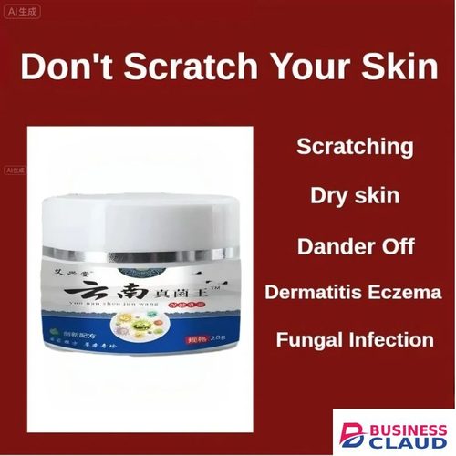 Antifungal Cream Kenya, Ringworm Treatment Cream, Athlete's Foot Solution, Jock Itch Relief, Natural Antifungal For Skin, Dermatologist-approved Skincare, Africa Fungal Infection Cream in Kenya-premium-incense-scent