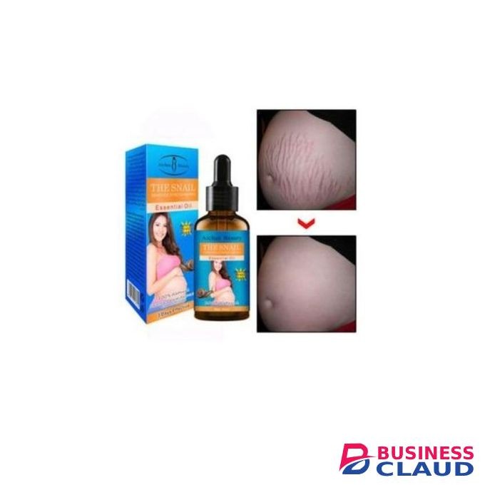 Aichun Beauty The Snail Removes Stretch Marks Essential Oil -30ml