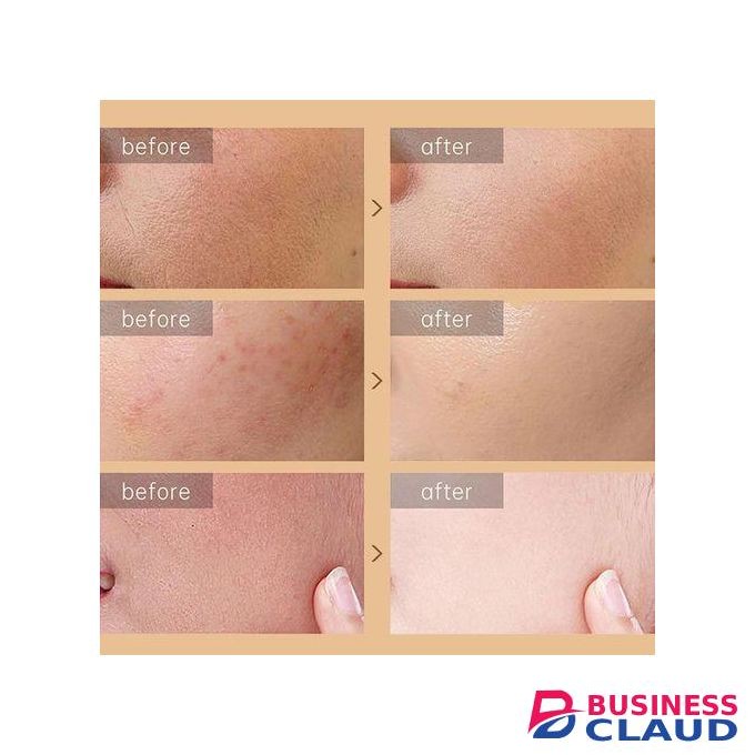 Snail Skin Repairing Cream – 3PCS