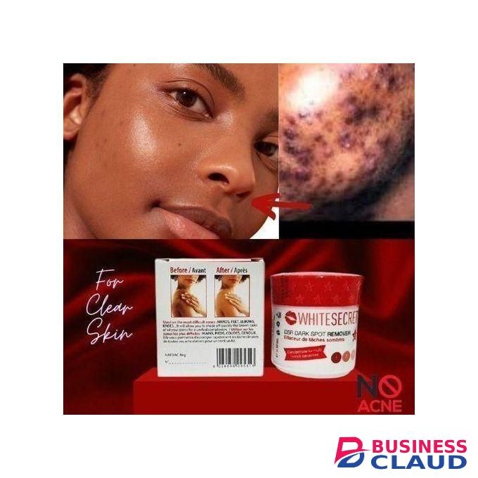 White Secret Dark Spot Remover